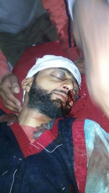 Youth killed after being hit by tear smoke shell
